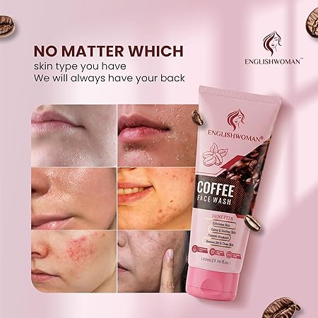 Coffee Face Wash – Exfoliates, Hydrates, Soothes Skin, Prevents Breakouts – For All Skin Types 100ml - Image 5